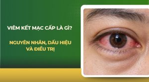 Viêm kết mạc cấp