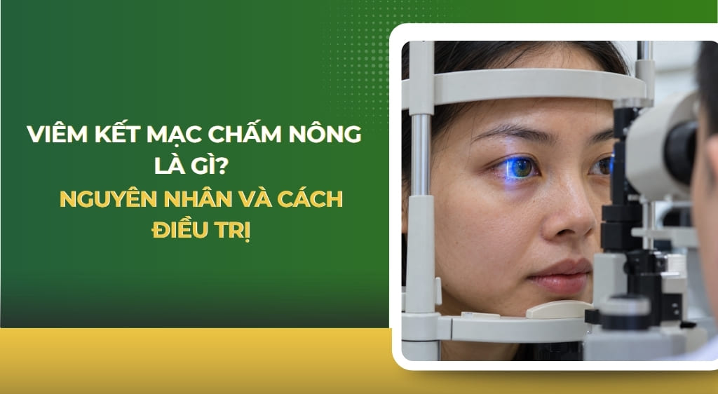 Viêm kết mạc chấm nông