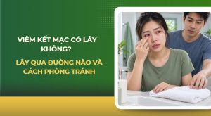 viêm kết mạc có lây không