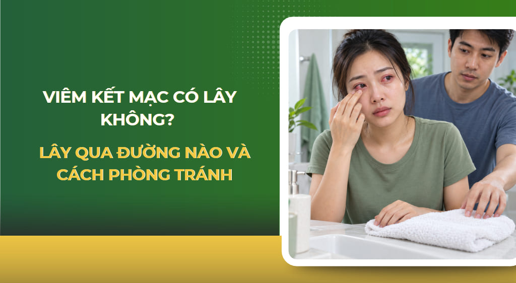 viêm kết mạc có lây không