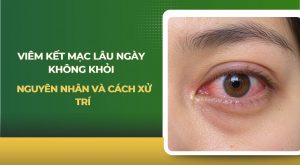 Viêm kết mạc lâu ngày không khỏi
