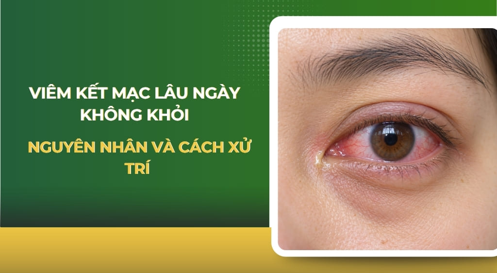 Viêm kết mạc lâu ngày không khỏi
