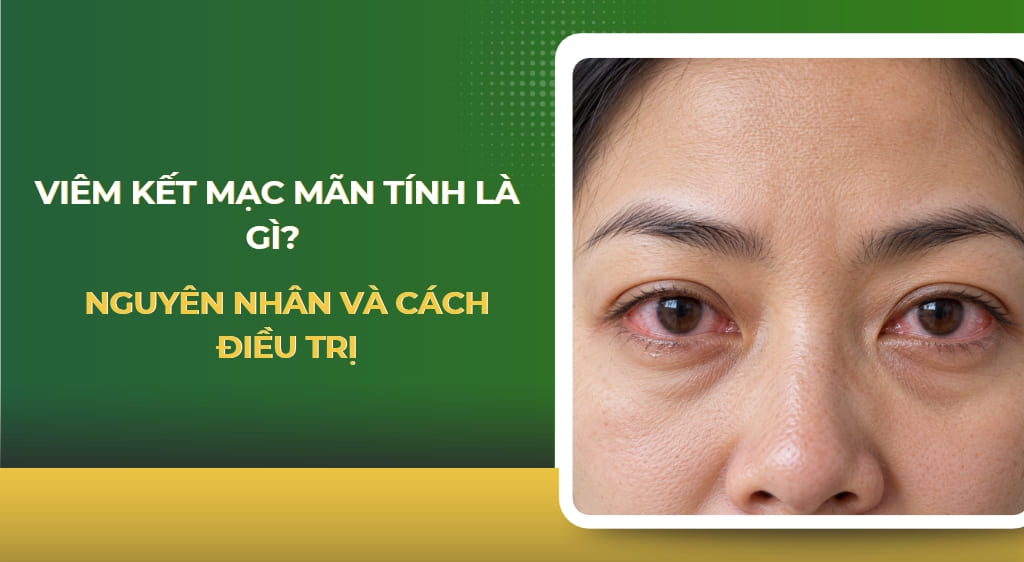 Viêm kết mạc mãn tính