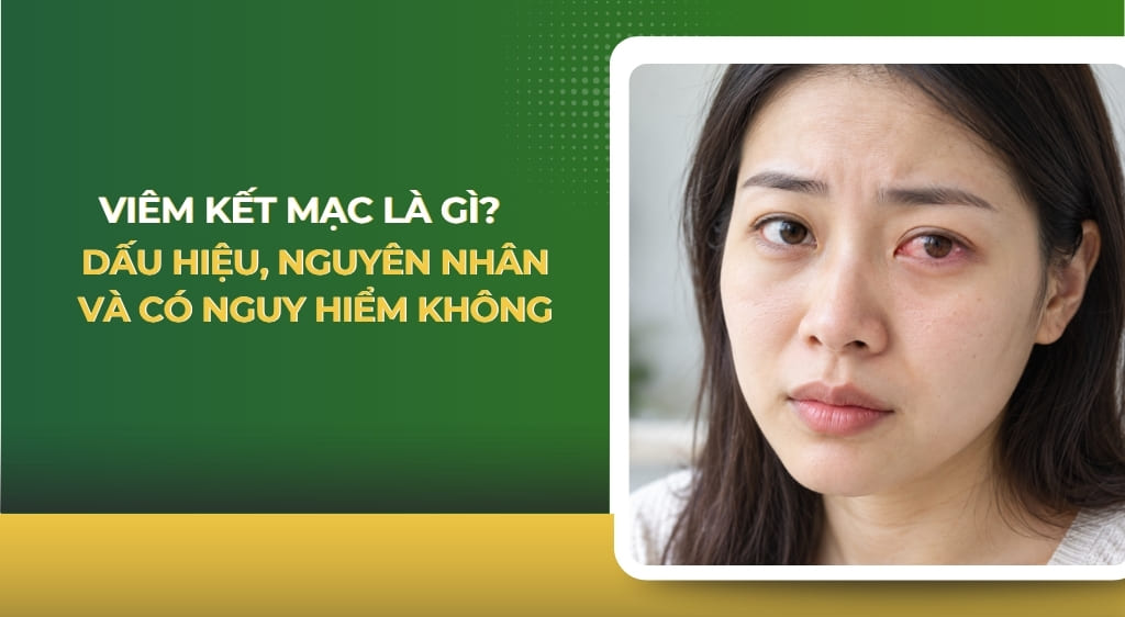 Viêm kết mạc